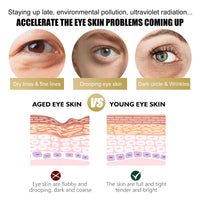 EELHOE Retinol Eye Cream Stick Reduces Eye Bags, Dark Circles And Wrinkles, Moisturizes And Tightenes The Skin Around The Eyes