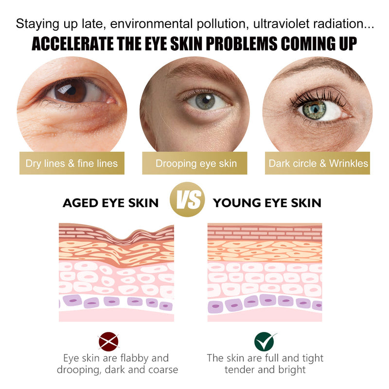 EELHOE Retinol Eye Cream Stick Reduces Eye Bags, Dark Circles And Wrinkles, Moisturizes And Tightenes The Skin Around The Eyes