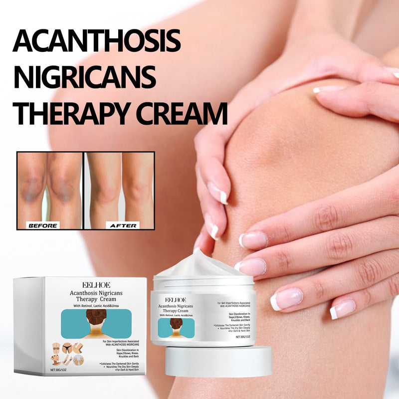 Acanthosis Nigricans Therapy Cream, Moisturizing And Repairing Armpit Joints Arm Black Whitening And Brightening Skin Care Cream