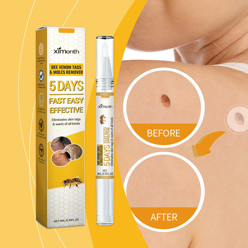 Ximonth Keyu Liquid Pen Clean Meat Granules Flat Especially Repair Skin Improve Skin Condition Fade Dark Spots
