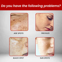 OUHOE Dark Spot Removal Cream, Moisturizing Repair Lighten Face Fine Lines And Spots Skin Whitening Cream