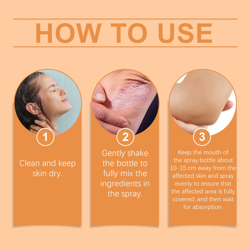 Moss Care Spray Repair Skin Moss Moisturizing Skin Anti-Itch Treatment Topical Spray
