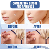 EELHOE Kew Patch Gentle Cleaning Care Skin Face Neck Repair Smooth Skin Daily Care