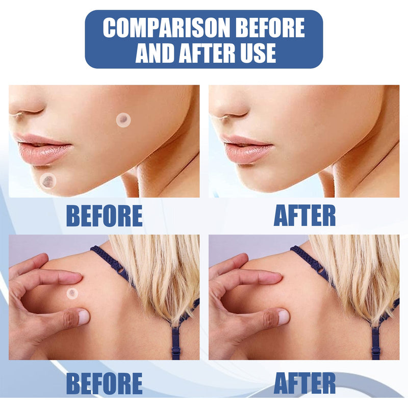 EELHOE Kew Patch Gentle Cleaning Care Skin Face Neck Repair Smooth Skin Daily Care