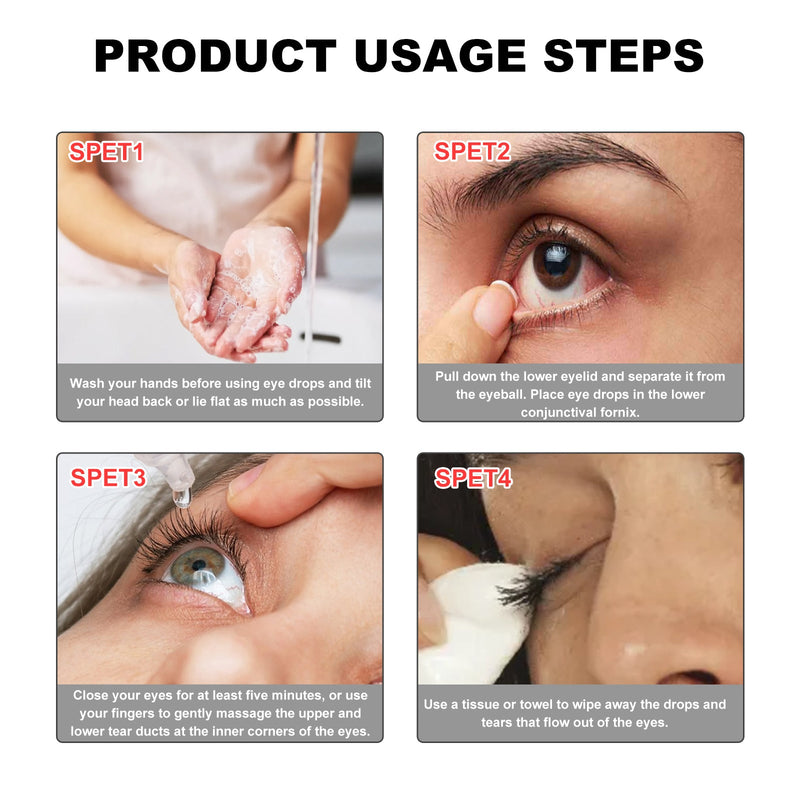 Iris Ink Eye Drops, Relieve Eye Fatigue And Dry Blurred Vision Moist Eye Color Eye Care Drops