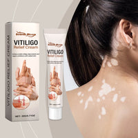 Body Care Cream, Relieve Itching And Swelling Of Hands And Feet Skin Moisturizing Skin Care Cream