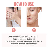 Hoygi Nicotinamide Essence Tights And Moisturizes Pores, Lighens Acne Marks And Spots, Moisturizes And Brighens Skin