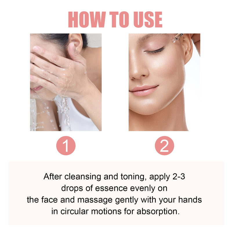Hoygi Nicotinamide Essence Tights And Moisturizes Pores, Lighens Acne Marks And Spots, Moisturizes And Brighens Skin