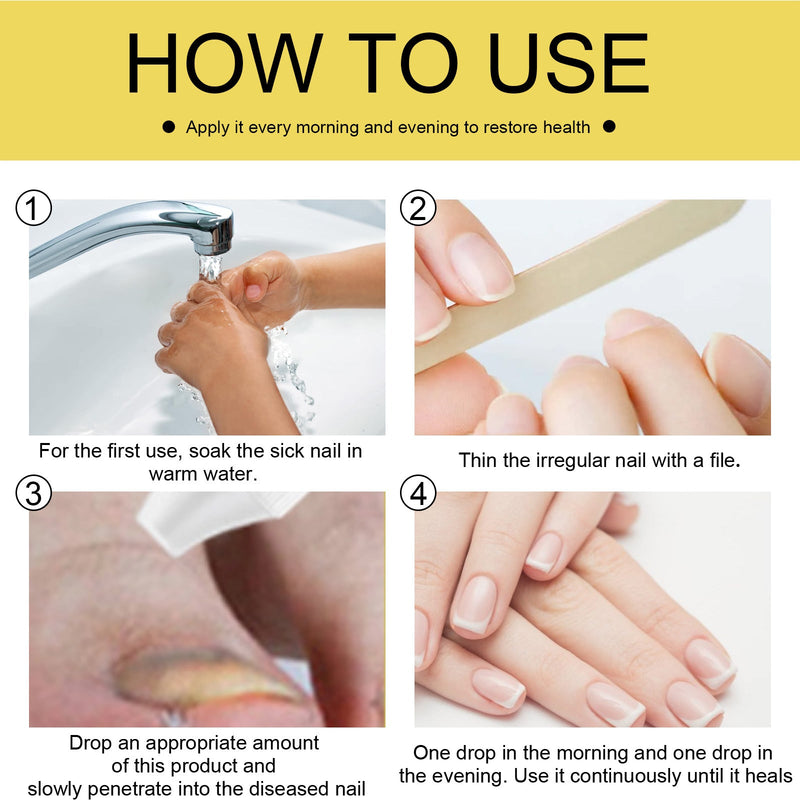 EELHOE Ginseng Nail Essential Oil Grey Nail Thickening Nail Repair Brightening Nail Removing Soft Nail Moisturizing Essence