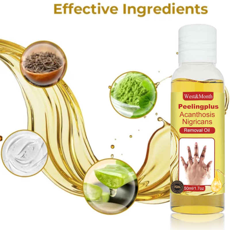 West&Month Acanthosis Nigricans Removal Oil, Exfoliating Light Black Brightening And Beauty Skin Oil