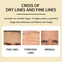 Forehead Mask, Lightening And Smoothing Forehead Wrinkles And Lines Firming Loose Skin Anti-Wrinkle Patch