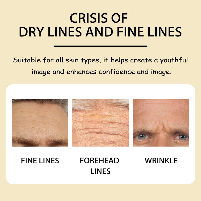 Forehead Mask, Lightening And Smoothing Forehead Wrinkles And Lines Firming Loose Skin Anti-Wrinkle Patch