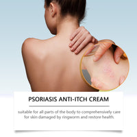 Ximonth Skin Care Cream Deeply Nourishes And Moisturizes Body Skin With A Gentle Daily Repair Cream