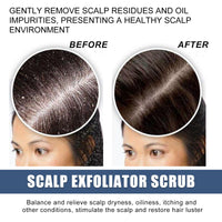 EELHOE Scalp Exfoliating Scrub Moisturizes Dry Hair And Scalp Cleansing Treatment Refreshing Scrub