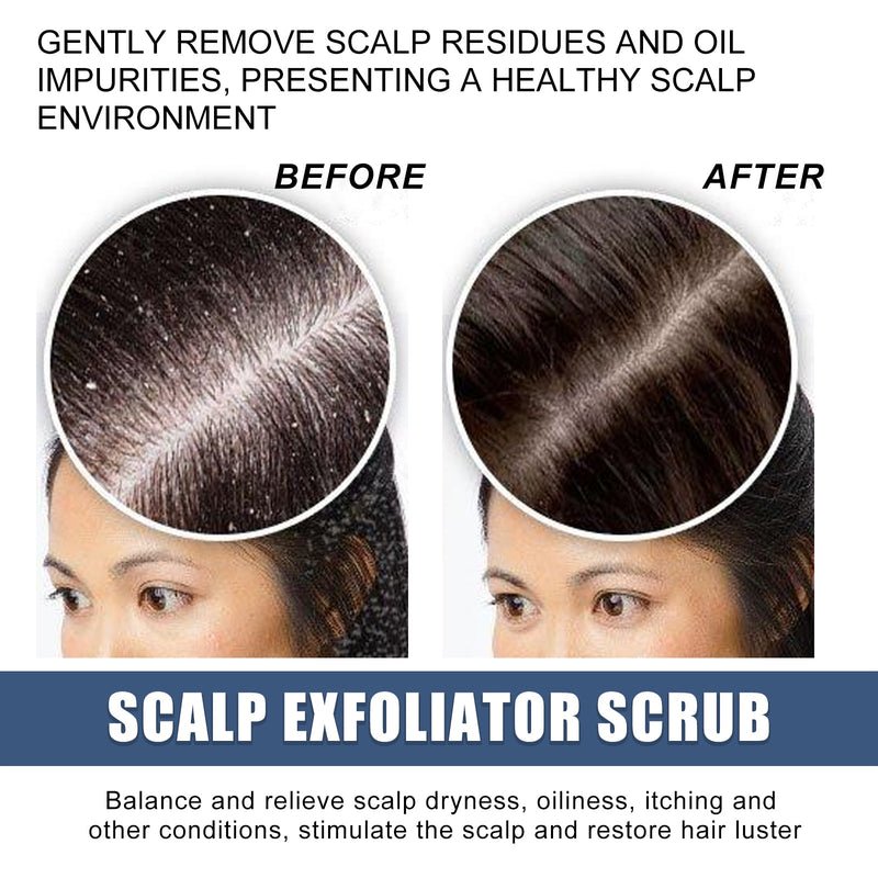 EELHOE Scalp Exfoliating Scrub Moisturizes Dry Hair And Scalp Cleansing Treatment Refreshing Scrub