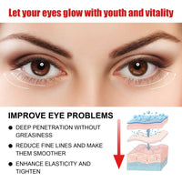 Jaysuing Nourishing And Moisturizing Eye Cream Keeps The Skin Around The Eyes Soft And Moisturized With A Gentle Daily Eye Cream
