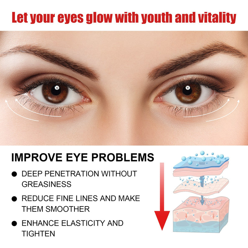 Jaysuing Nourishing And Moisturizing Eye Cream Keeps The Skin Around The Eyes Soft And Moisturized With A Gentle Daily Eye Cream