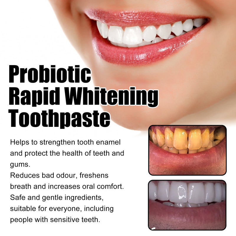 Probiotic Rapid Whitening Toothpaste, Fresh Breath To Remove Stains And Tartar White Teeth To Remove Odor And Beautiful Teeth