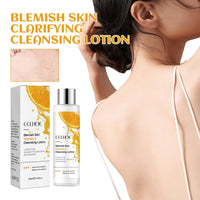 Spot Cleanser Deeply Cleanses Face Body Skin, Lightens Spots, Brightens Skin
