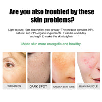 EELHOE Skin Care Cream Improves Dull Skin, Moisturizes Skin, Brightened Skin Care Cream And Clears Acne