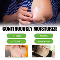 Multi Purpose Psoriasis Cream, Relieve Itchy Skin Red Body Pain Nursing Care Moist Skin Itching
