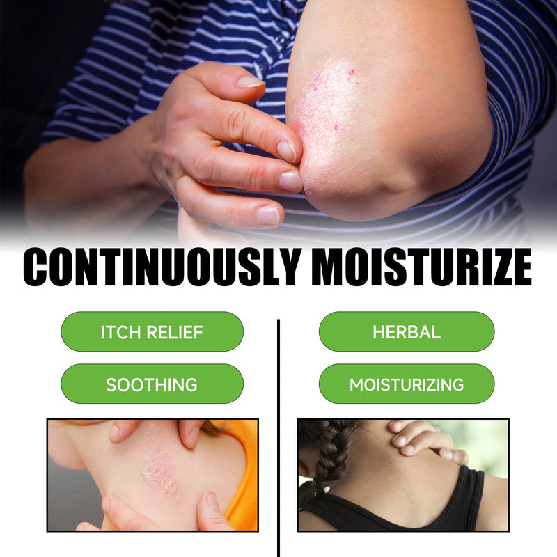 Multi Purpose Psoriasis Cream, Relieve Itchy Skin Red Body Pain Nursing Care Moist Skin Itching