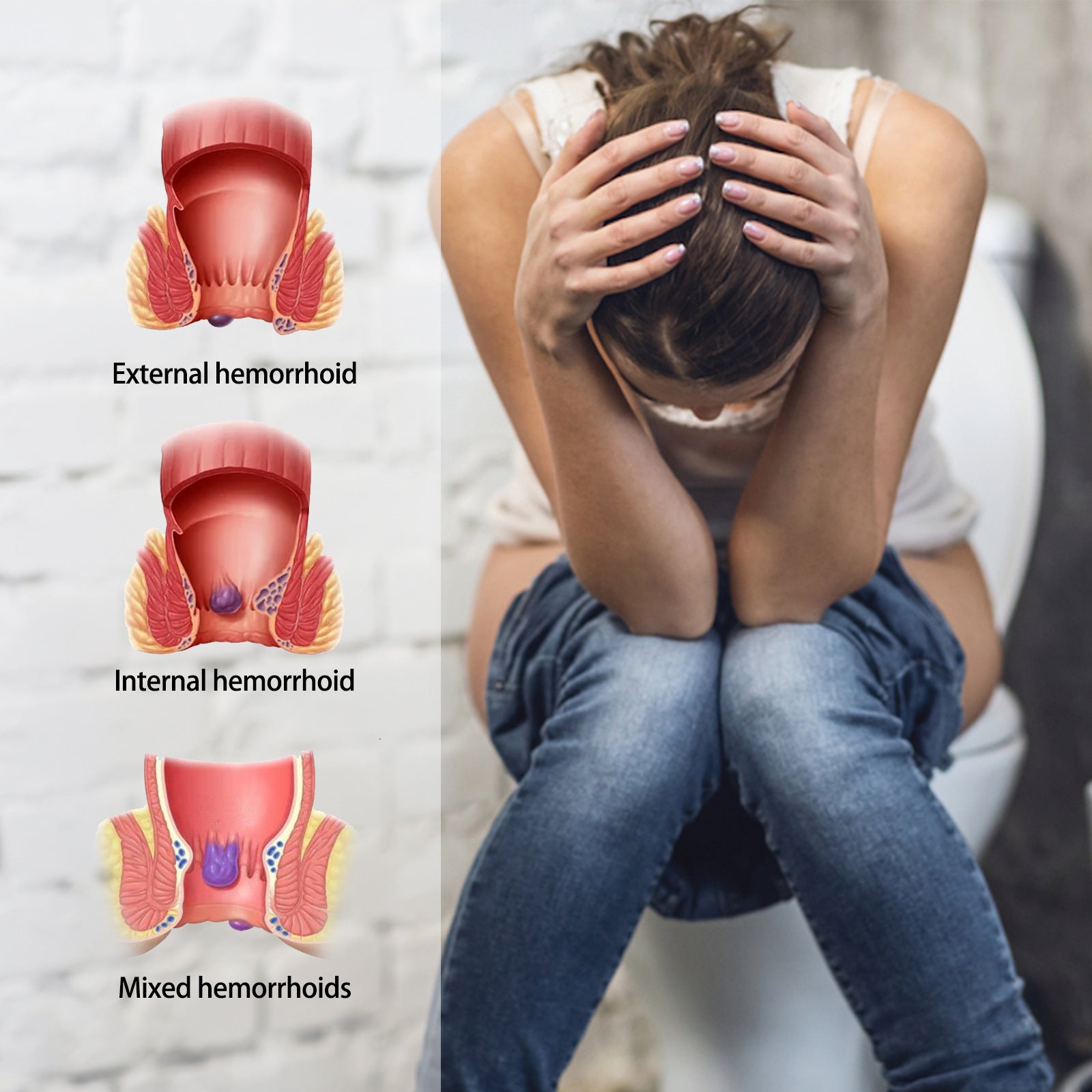 South Moon Hemorrhoid Soothing cream, Hemorrhoid gel cream, anal swelling, pain and itching herbal cream