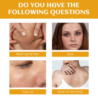 Spot Cleanser Deeply Cleanses Face Body Skin, Lightens Spots, Brightens Skin
