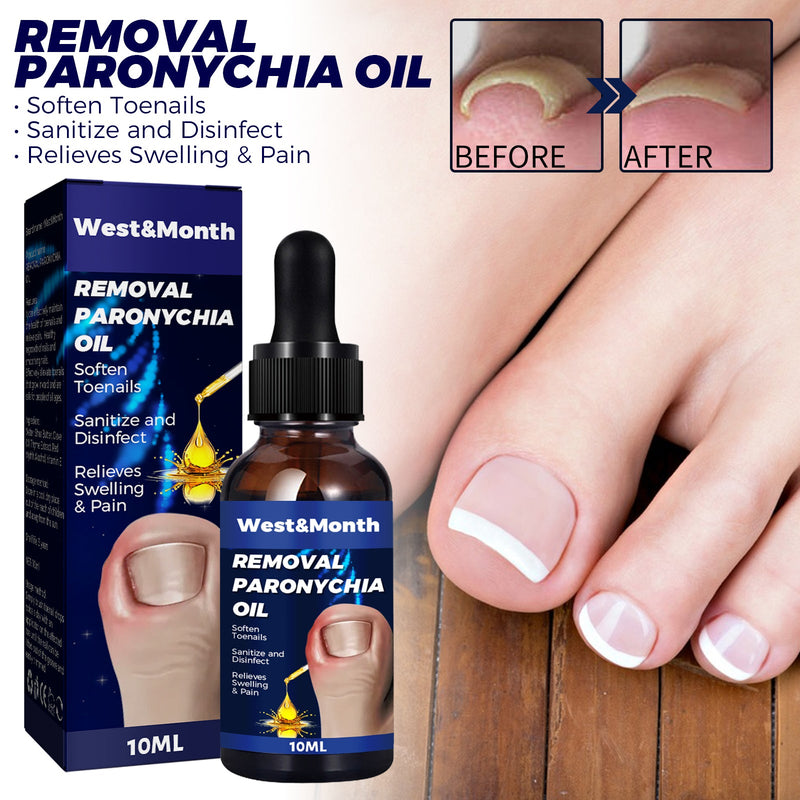Nail Repair Oil Hand And Foot Repair Inlaid Toenails Soft Nails Daily Moisturizing Nail Care