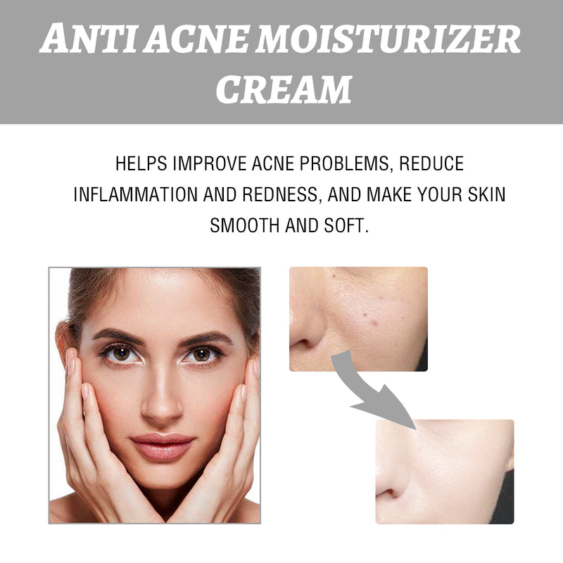 EELHOE Hydrating Cream - Lightens Acne Redness, Brightening Moisturizing Care