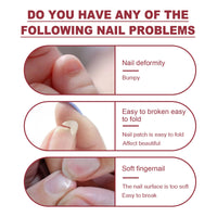 Jaysuing Fiber Extension Gel (20ml) Nail Anti-Crack Nail Art Nail Light Therapy Extension Gel Burst Nail Gel