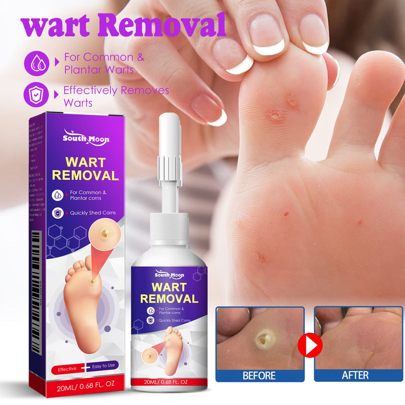 South Moon Remove Chicken Eye Lotion Extra Clear Remove Corns Skin Care Chicken Calluses Foot Pad Gram Warts