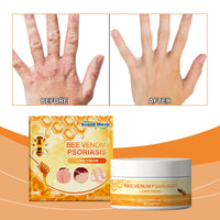 Skin Repair Cream, Skin Repair Cream For The Body And Hands And Feet