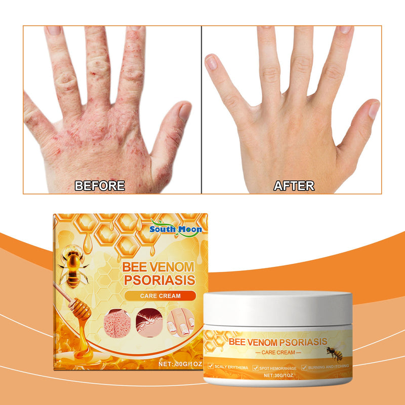 Skin Repair Cream, Skin Repair Cream For The Body And Hands And Feet