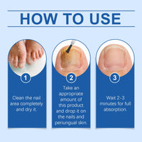 South Moon Nail Care Essence, Clean Fingernails Odor Soft Nail Groove Moisturizing Nail Care Solution