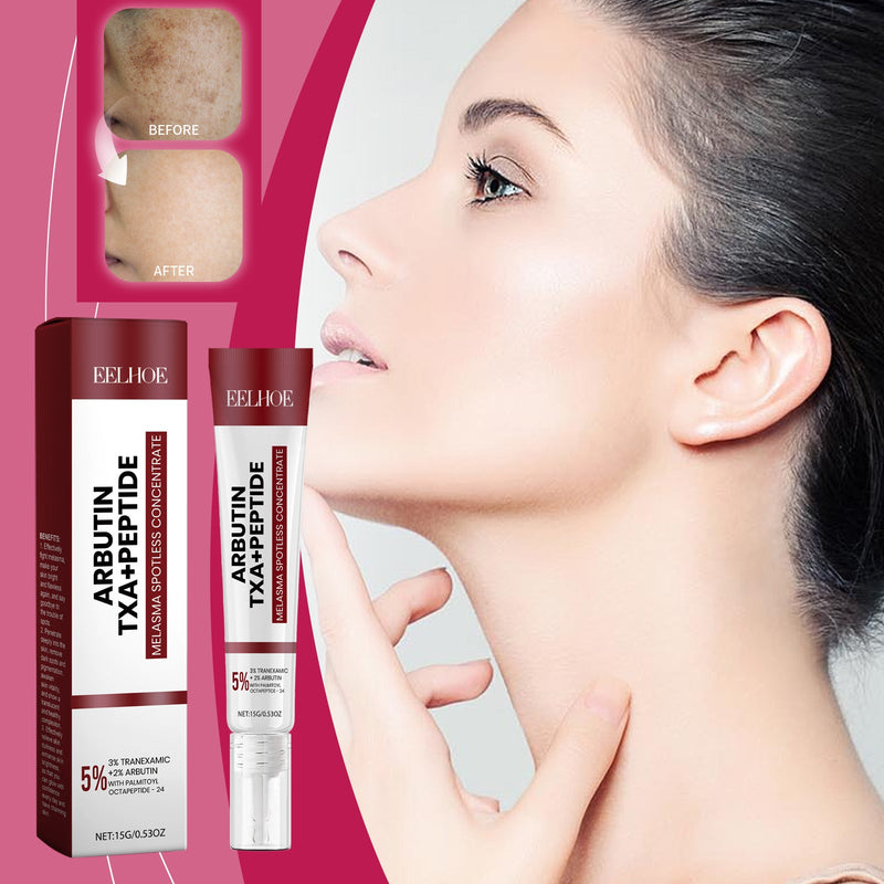 Melasma Spotless Concentrate, Moisturizing Firming Skin Refreshing And Dark Spots Skin Creams