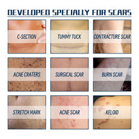 West&Month High-Grade Formula Scar Gel, Scar Repair Surgery Scar Pregnancy Smoothing Skin Care Gel