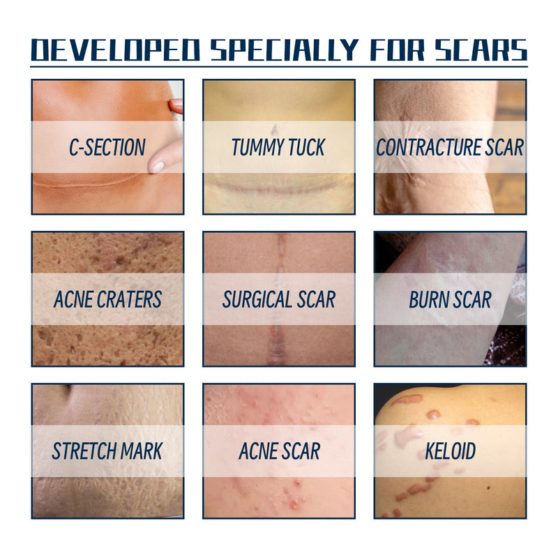 West&Month High-Grade Formula Scar Gel, Scar Repair Surgery Scar Pregnancy Smoothing Skin Care Gel