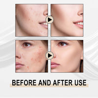 Lactose Solution, Exfoliate Remove Blackheads Shrink Pores Clean And Moisturize SkinEssence