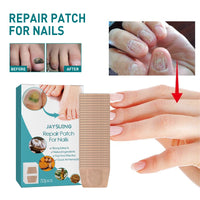 Nail Repair Patch, Hand And Foot Nail Care Soft Nail Inlay Nail Thickening Gray Nails Bright Nails Patch