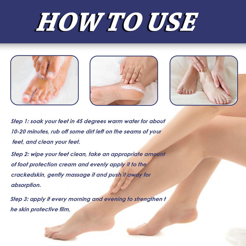 South Moon Urea Hand And Foot Cream, Anti-Crack Peeling Repair Skin Crack Dry Moisturizing Skin Soothes Skin