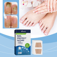 Nail Repair Patch, A Gentle And Clean Hand, Foot And Foot Nails Soft And Moisturizing Nail Repair Patc