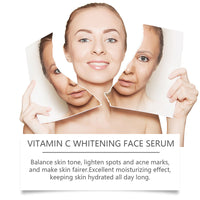 West&Month Vitamin C Face Serum, Moisturizing, Hydrating, Brightening, Tender And Smooth Skin Essence