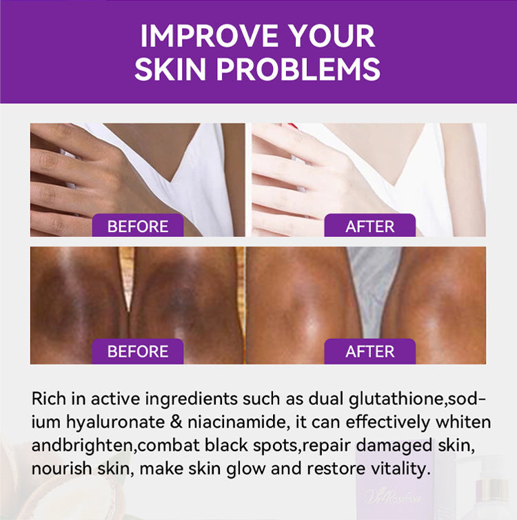 Lightening Body Lotion With Glutathione For Brightening And Reducing Melanin