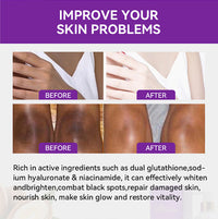 Lightening Body Lotion With Glutathione For Brightening And Reducing Melanin