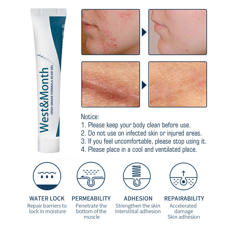 West&Month High-Grade Formula Scar Gel, Scar Repair Surgery Scar Pregnancy Smoothing Skin Care Gel