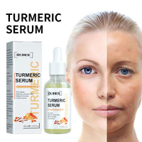 Turmeric Facial Repair Essence, Skin Repair Remove Dark Spots Anti-Wrinkle And Moisturize Essence