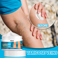Varicose Veins Cream, Muscle Soreness And Swelling Relief Discomfort Smoothing Blood Vessel Massage Cream