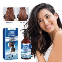 Scalp Antipruritic Hair Shampoo, Smoothing Hair And Moisturizing Scalp Dense Hair Anti-Fixative Shampoo