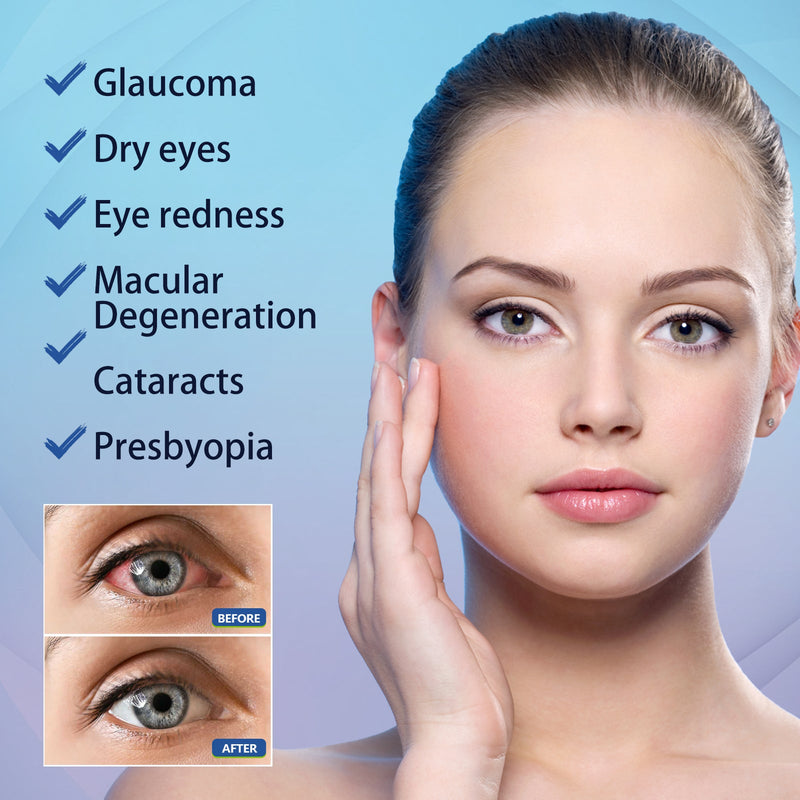 EELHOE Lubricant Eye Drops, Relieve Redness Eye Fatigue Dryness Blurred Vision And Moisturize Eye Care Solution